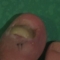 toe_0001.jpg