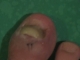 toe_0001.jpg