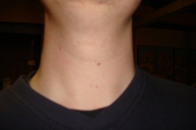 My throat