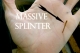 massivesplinter.jpg