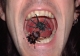 mouthspiders.jpg