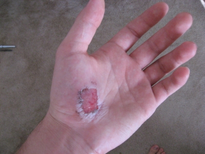 My Hand again