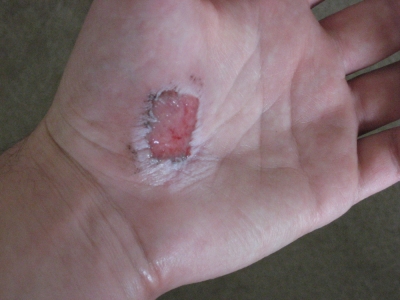 My hand