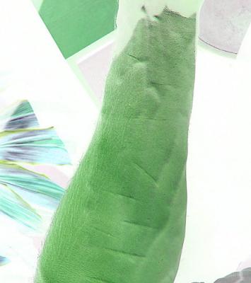 Photosynthetic arm