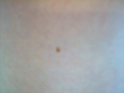 And now, Below the Belt.