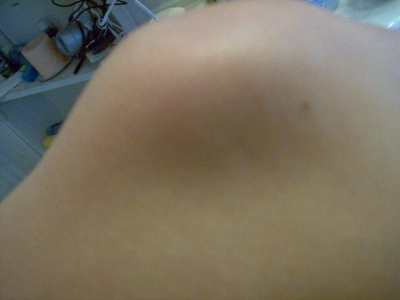 Knees tell a story...