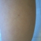 Tiny