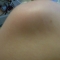 Knees tell a story...