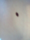 Armpit Monster