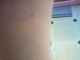 *Thigh*