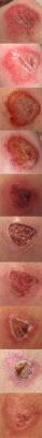 Skin construction