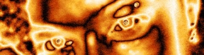 sudden reanimation - April 2008