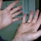 Blackened hands