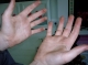 Blackened hands