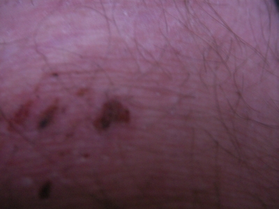 A day or two later...