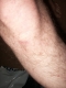 All Healed
