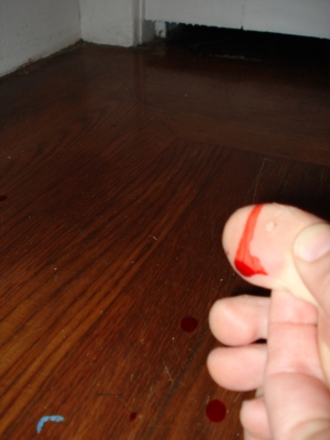 That metal mesh is dangerous--