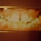 My 9 year old teeth