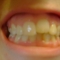 My 21 year old teeth