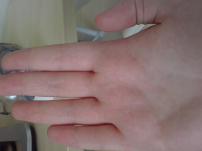 Hand Before, normal colour as you can see.