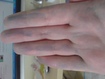 After washing green off, some bits are still dyed =/ haha