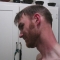Sunburn