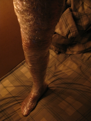 Leg taped