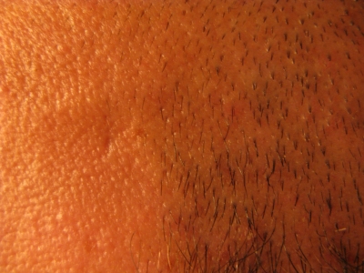 Side of my head Side of my head