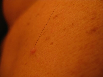 This is on my back. This is on my back.