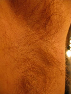 Armpit Armpit