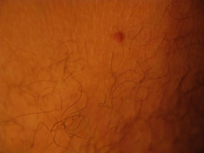 Mole Mole