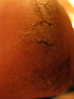 More heel cracks More heel cracks