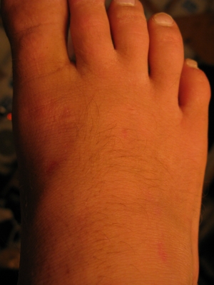 Top of foot Top of foot
