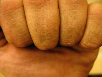 Dirty knuckles Dirty knuckles