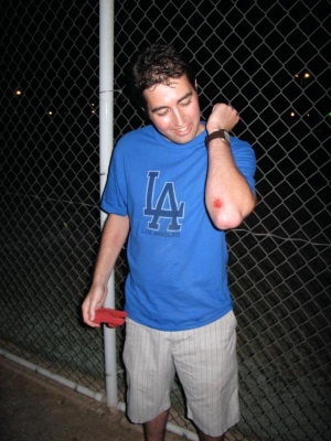 The hazards of running.