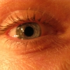 Right eye
