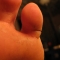 Cut on my toe