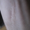 The Callouses on Your Hands by Lincøln The Callouses on Your Hands by Lincøln