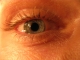 Right eye