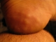 Those little balls