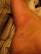 Side of my foot