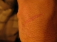 Doorhenge scar