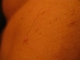 This is on my back. 