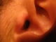 In the ear