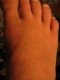Top of foot