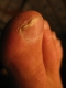 Old Injury
