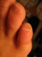 Cuticle wear