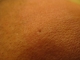 Side of forehead