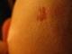 Fresh(ish) wound