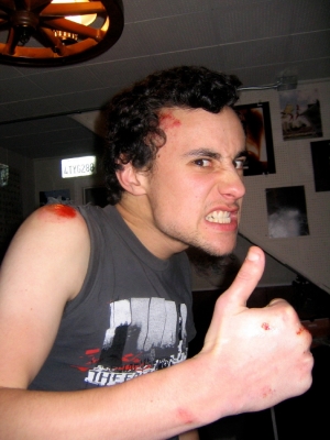 ouch!